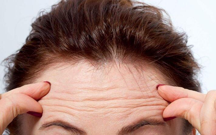 抬头纹怎样才能去除 如何通过注射瘦脸针或面部拉皮去除抬头纹