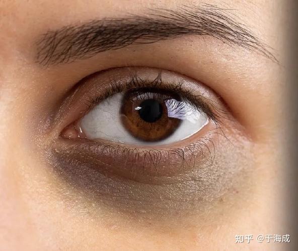 熬夜怎么消除黑眼圈 如何通过化妆来消除黑眼圈